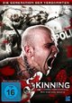 Skinning - Wir sind das Gesetz Skinning - Wir sind das Gesetz